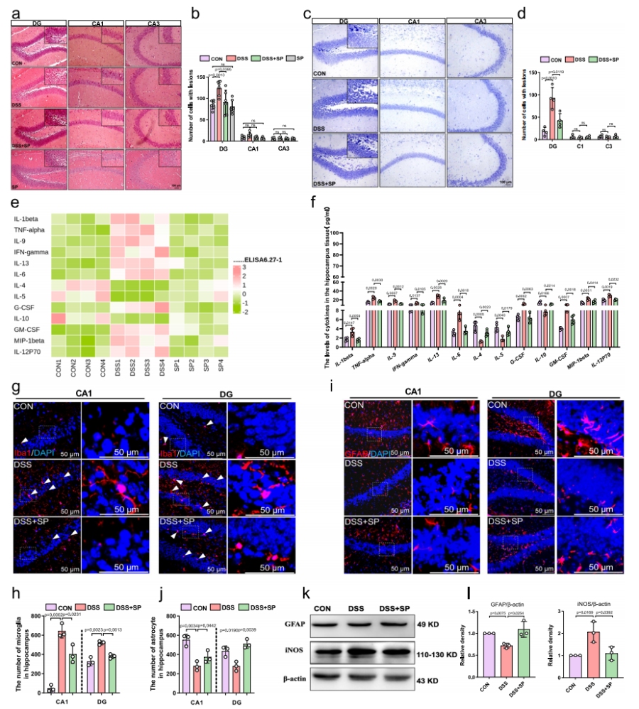 圖2 SP減輕DSS誘導小鼠的海馬損傷及神經(jīng)炎癥反應