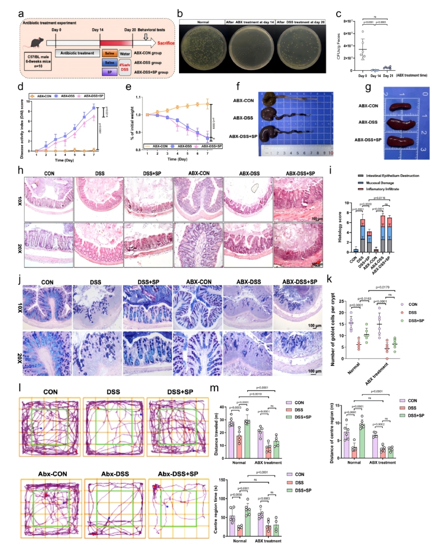 圖4 SP以腸道微生物群依賴(lài)性方式預防DSS誘導的腸道損傷及焦慮樣障礙